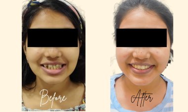 Teeth Care Multispeciality Dental Clinic Being the Best Dental Braces Center in Kolkata